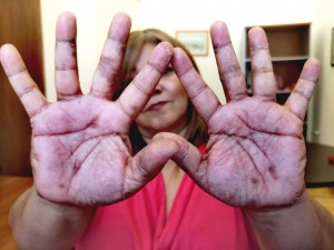 Maribel Bustamante, de los CCRS, muestra sus manos, "dañadas por el agua envenenada" de la mina. "Luchamos porque no queremos que se repita una tragedia como la de 2014".  